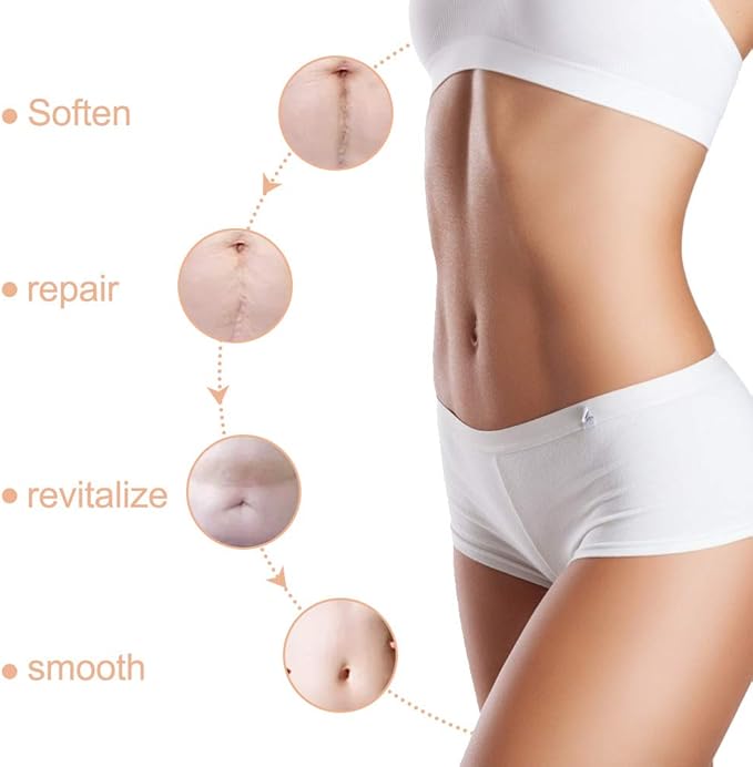 Silicone Scar Sheets