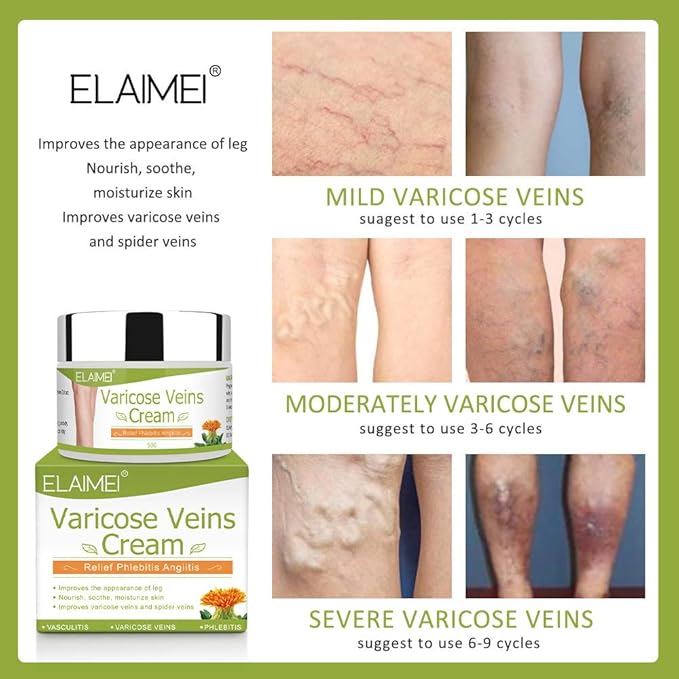 Vein Cream for Legs