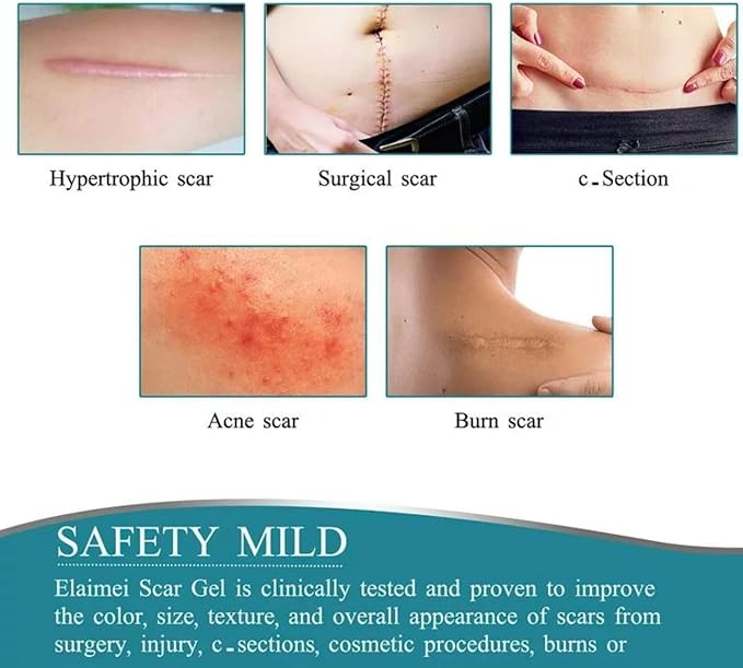 Emille Beauty 2PCS Silicone Scar Sheets