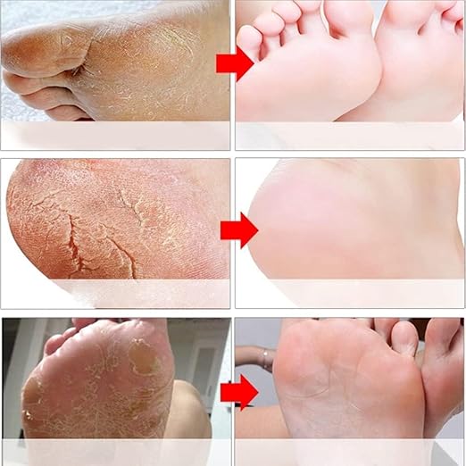 Foot Peel Mask 6 Pack