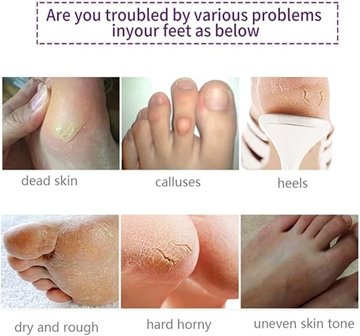 Foot Peel Mask 6 Pack