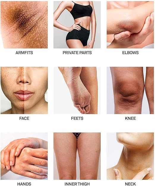 ELAIMEI Underarm Cream