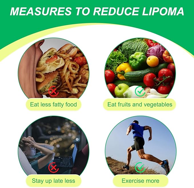 POSICHE Lipoma Cream