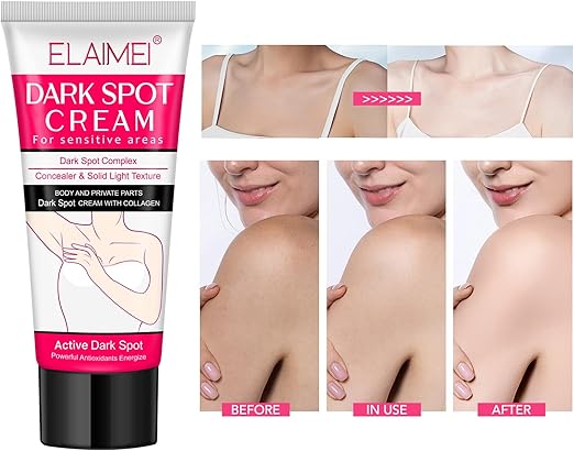 ELAIMEI Underarm Cream